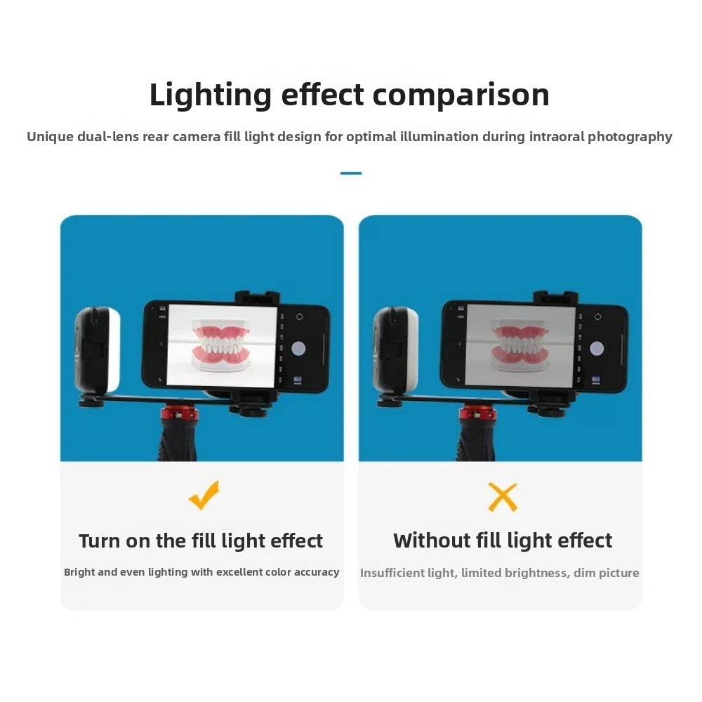 Licht für zahnärztliche Fotogr – Photography Lighting Kit Portable Bewertung und Preis